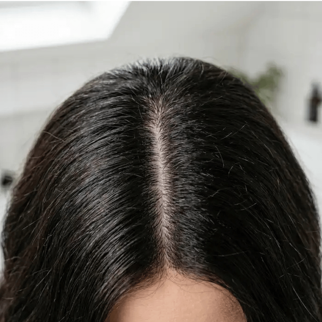 image showing healthy hair parted in the center