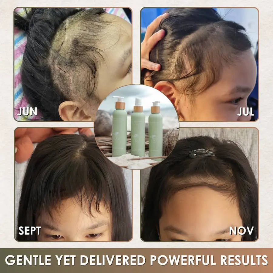 Before and after hair growth comparison with product bottles in the center.