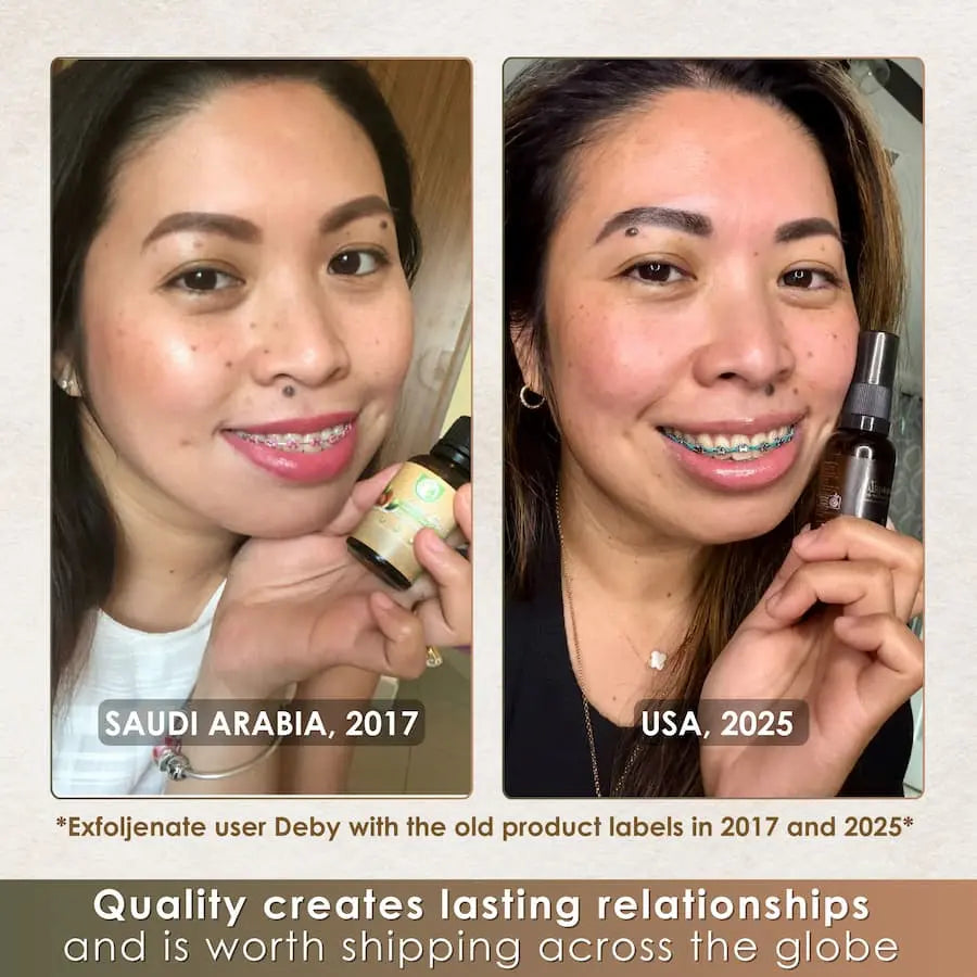 Before and after comparison of a woman using skincare products in Saudi Arabia in 2017 and USA in 2025.