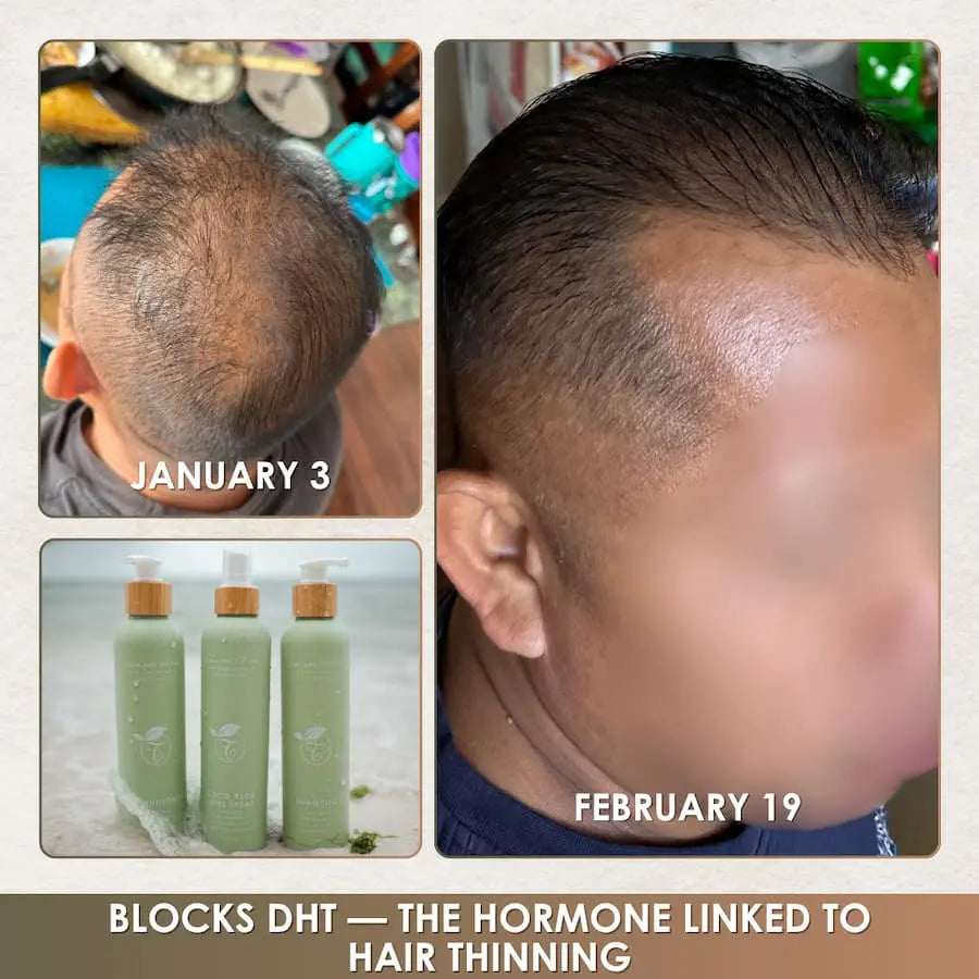 Before and after comparison of hair growth with product bottles labeled 'Blocks DHT'.